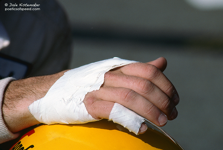 senna.bandaged.hand.sign